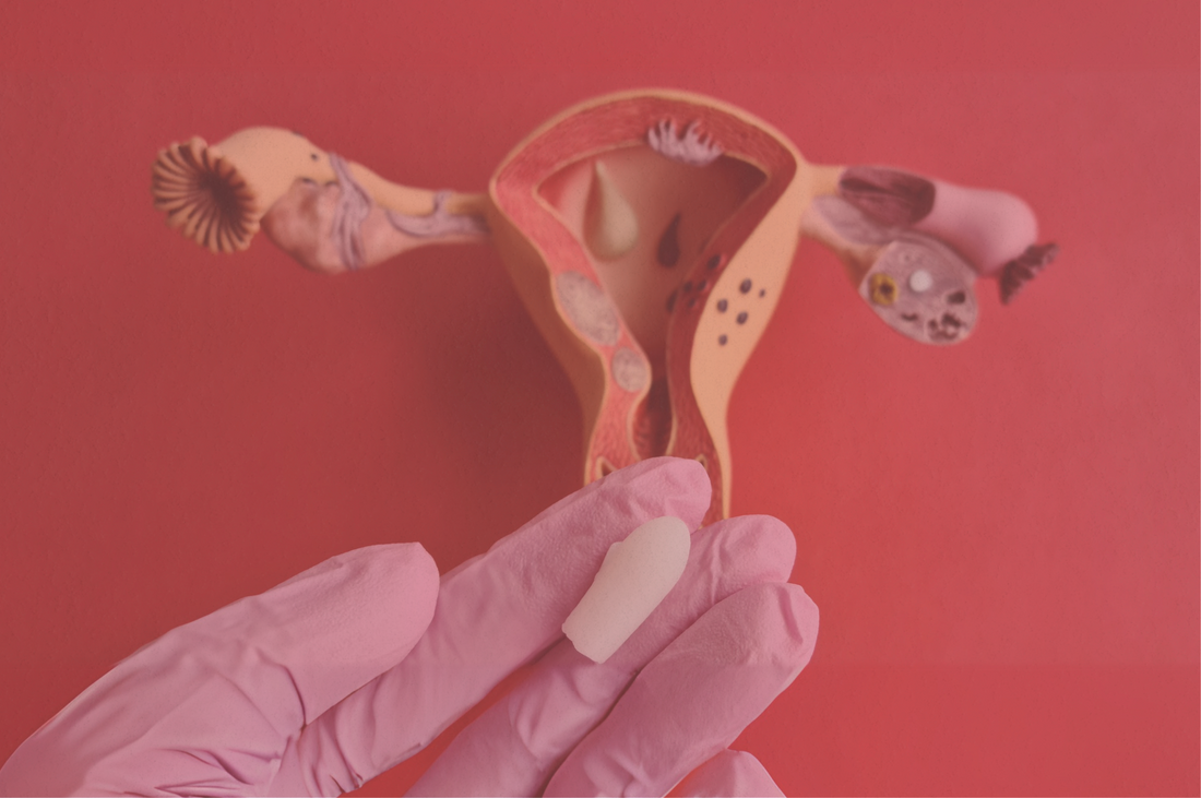 How to Spot, Treat, and Prevent Common Vaginal Infections