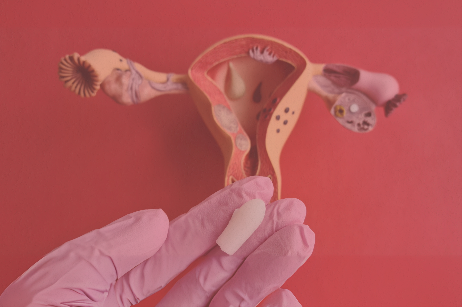 How to Spot, Treat, and Prevent Common Vaginal Infections