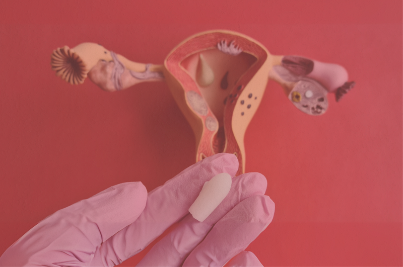 How to Spot, Treat, and Prevent Common Vaginal Infections
