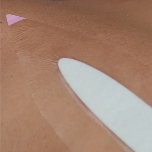 Close-up of skin with a white applicator and a pink triangular sticker.